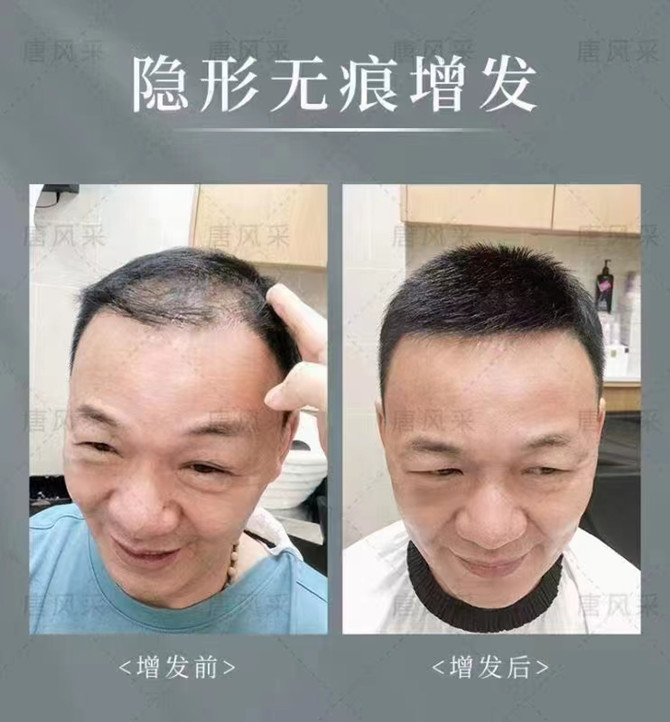 北京朝陽哪里有賣假發(fā)的 \