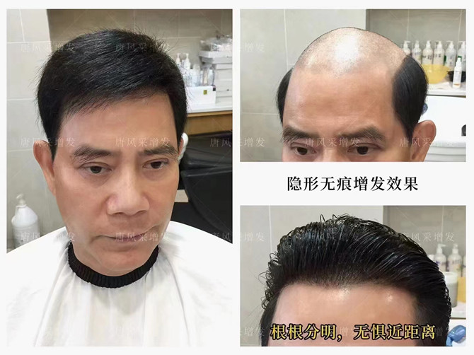 北京朝陽哪里有賣假發(fā)的 \