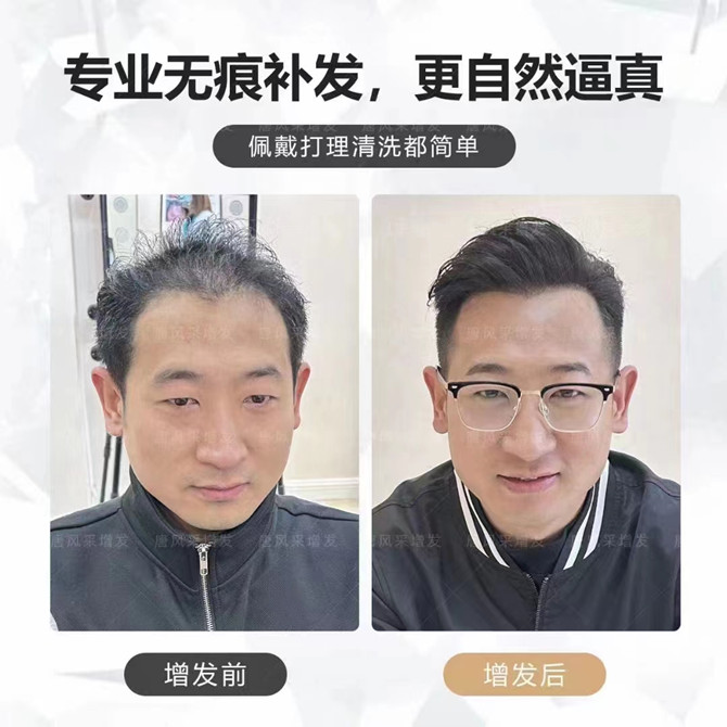 假發(fā)定制哪家最好 \