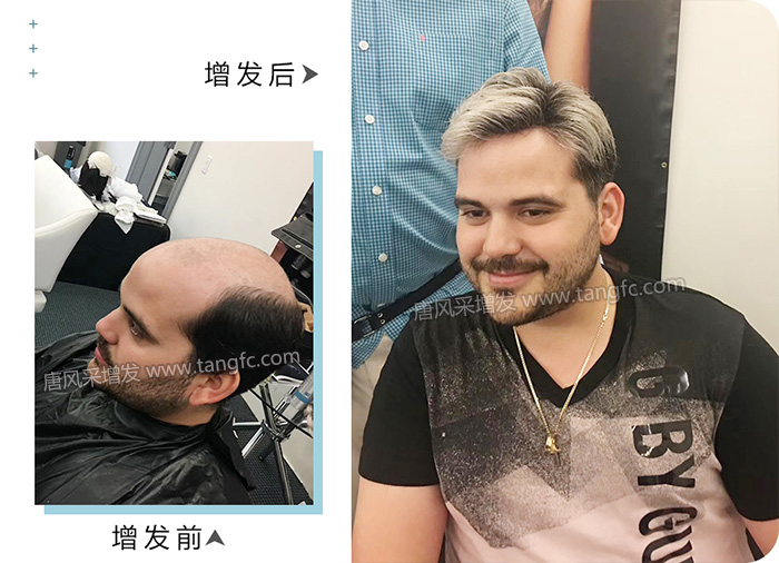 男的戴假發(fā)能看出來嗎 \