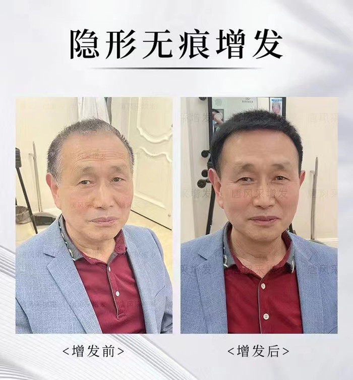 補(bǔ)發(fā)假發(fā) \