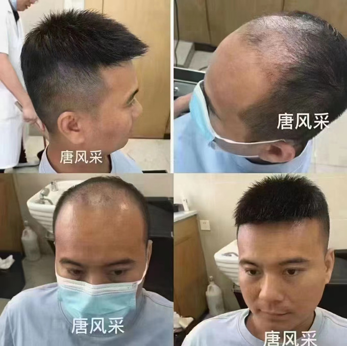 隱形補發(fā) \