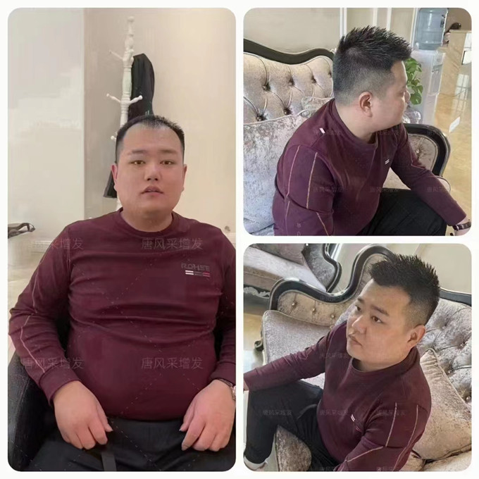 隱形補發(fā) \