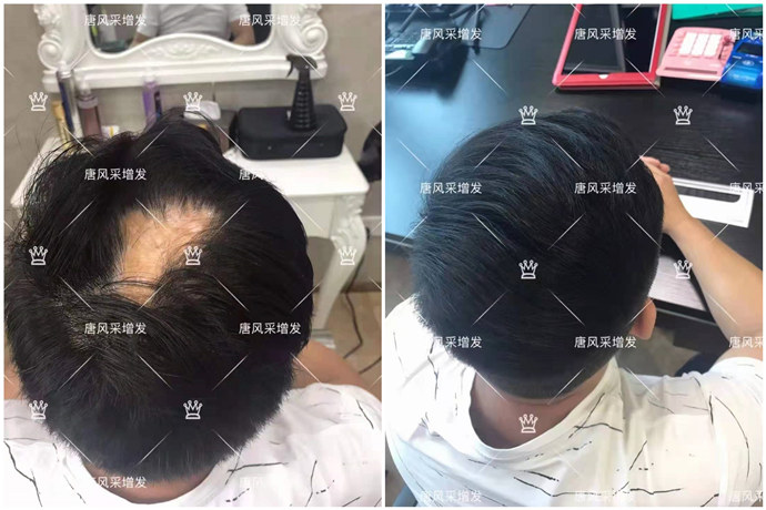 隱形補發(fā) \
