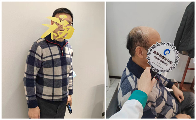 西寧假發(fā)設(shè)計(jì) \