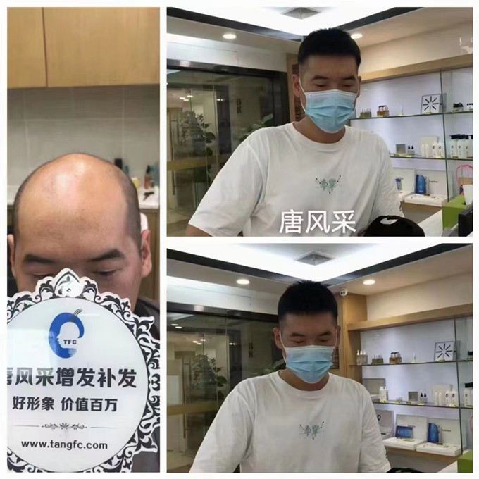 隱形增發(fā) \