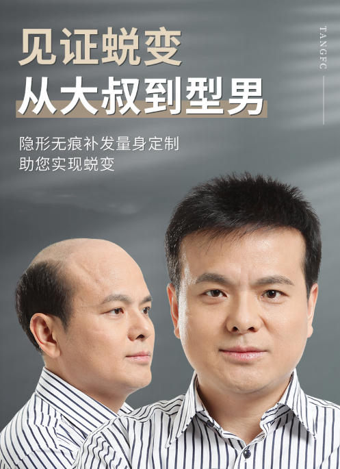 隱形增發(fā) \