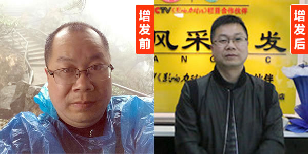 上海假發(fā)專賣店 上海假發(fā)專賣店---唐風(fēng)采是發(fā)友們心中的地標