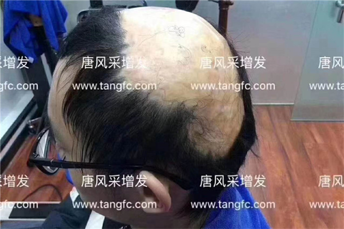 石家莊男士假發(fā)哪家強 \