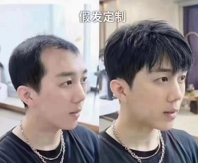 福州男士假發(fā)怎么選 \