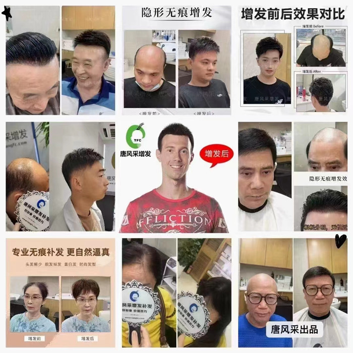 天津定制假發(fā)哪家好 \