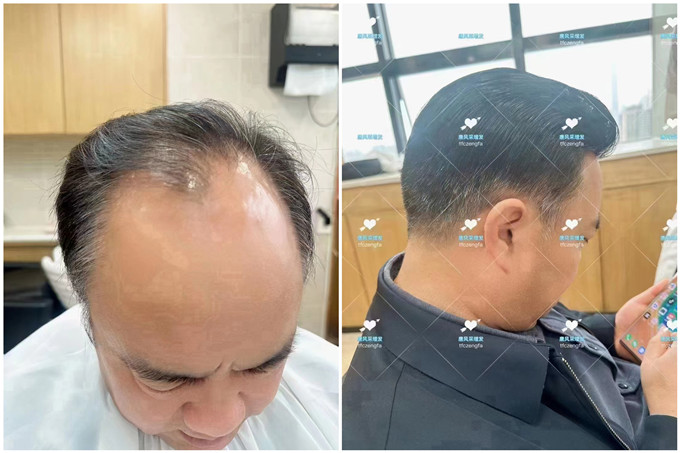 長(zhǎng)沙芙蓉區(qū)假發(fā)店 \