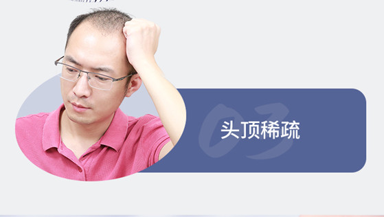 烏魯木齊定制男士假發(fā) \