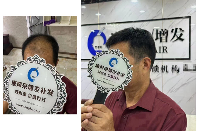 大連假發(fā)去哪里買(mǎi)比較好 \