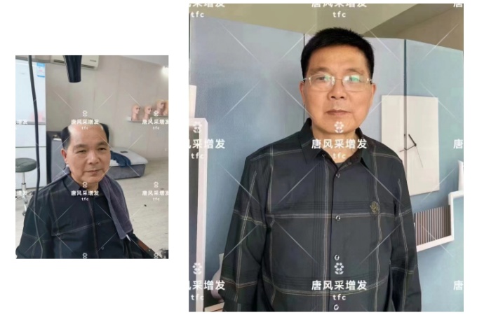 南昌哪有假發(fā)實(shí)體店 \