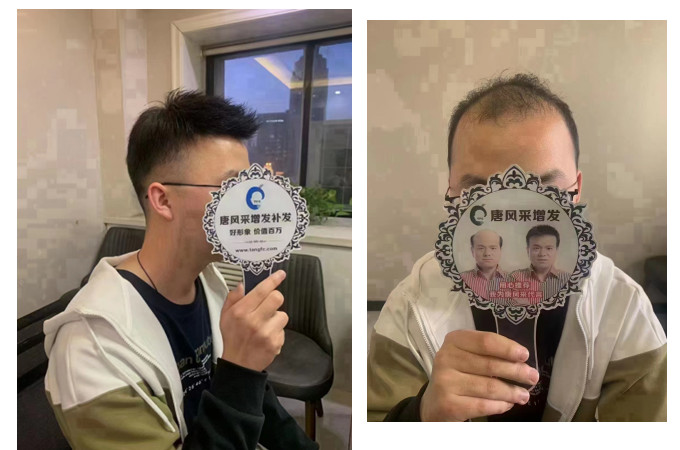 南昌哪有假發(fā)實(shí)體店 \