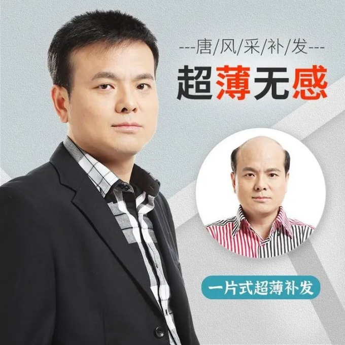 定制假發(fā)佩戴體驗 \