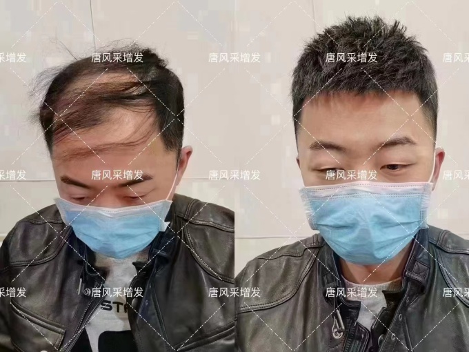 定制假發(fā)佩戴體驗 \