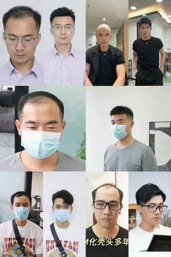 定制假發(fā)佩戴體驗 \