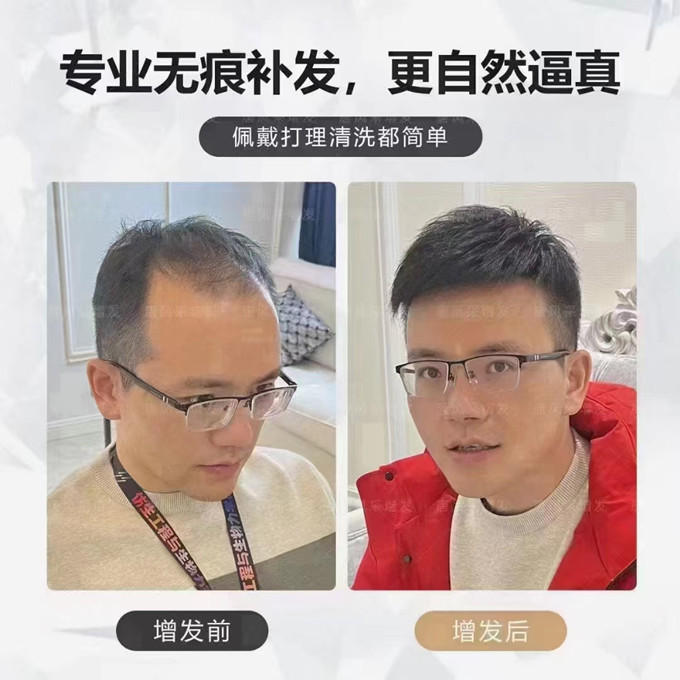 北京做定制男假發(fā) \