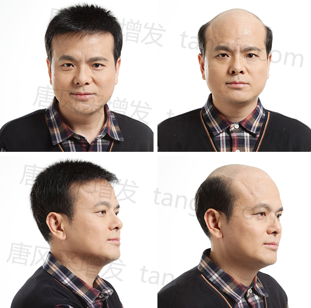 唐風(fēng)采溫州假發(fā)定制 \