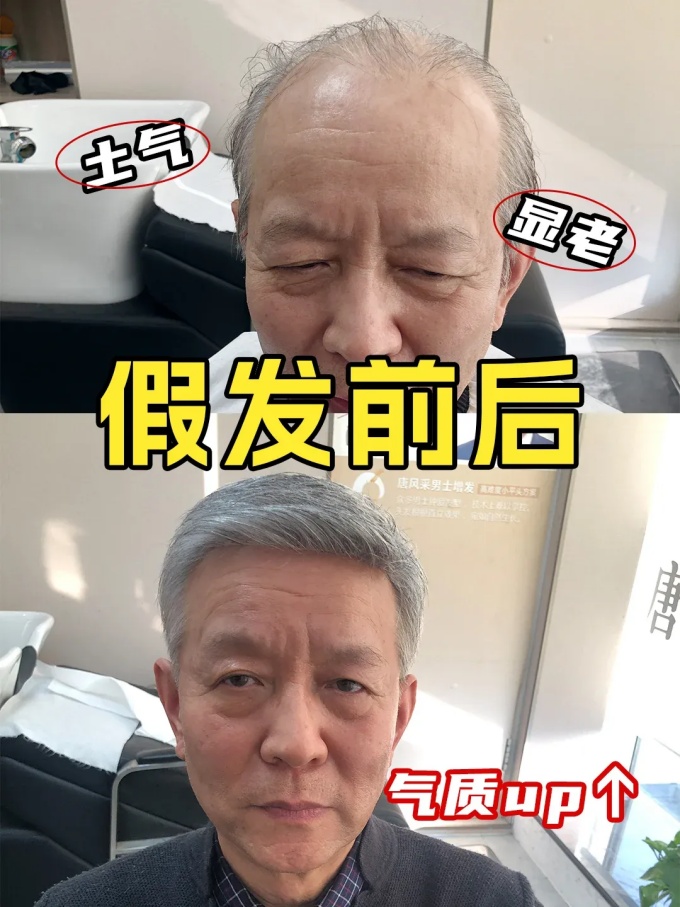 發(fā)量危機 \