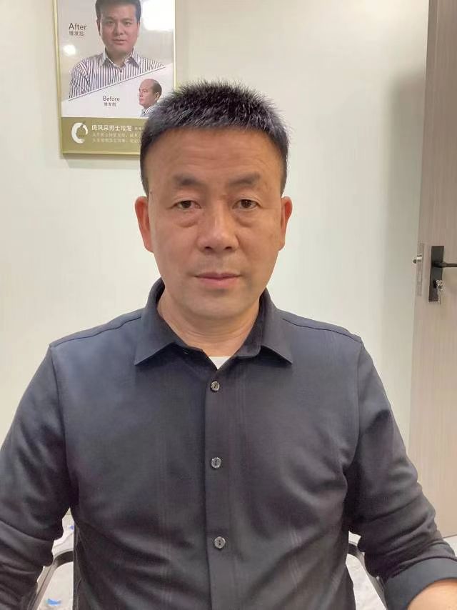 長沙假發(fā)定制哪家好 \