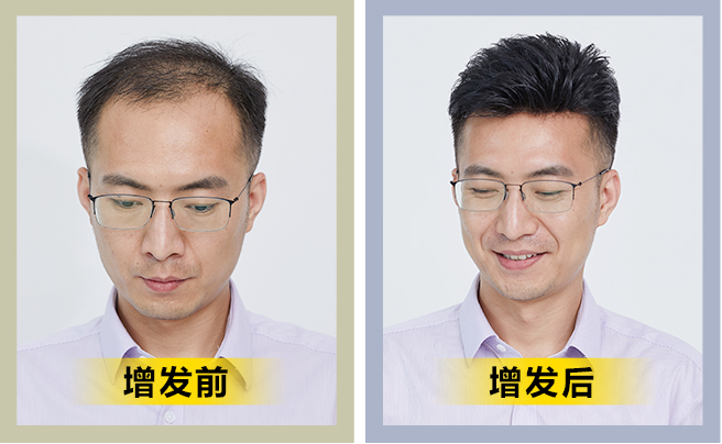 福州假發(fā) \