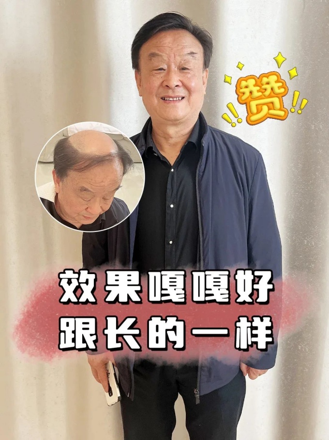 福州假發(fā) \